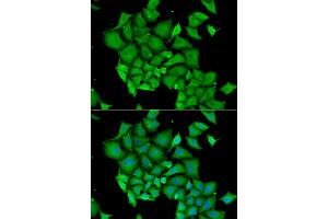 Immunofluorescence analysis of HeLa cell using DFFA antibody. (DFFA 抗体)