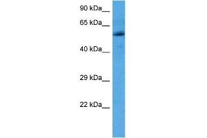 Host:  Rabbit  Target Name:  OXCT2  Sample Tissue:  Human Breast Tumor lysates  Antibody Dilution:  1ug/ml (OXCT2 抗体  (N-Term))