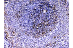 IHC analysis of VCAM1 using anti-VCAM1 antibody . (VCAM1 抗体  (AA 25-270))