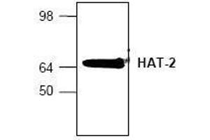 Image no. 1 for anti-MYST Histone Acetyltransferase 2 (MYST2) (N-Term) antibody (ABIN155154) (MYST2 抗体  (N-Term))