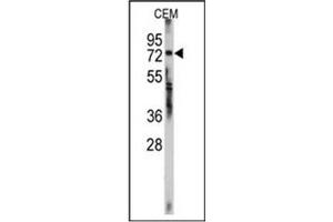 Image no. 1 for anti-Zinc Finger Protein 219 (ZNF219) (AA 660-690), (C-Term) antibody (ABIN357353) (ZNF219 抗体  (C-Term))