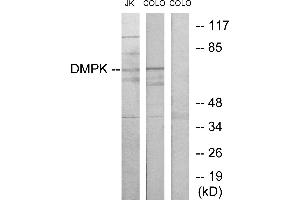 Western blot analysis of extracts from Jurkat cells and COLO205 cells, using DMPK antibody. (DMPK 抗体)