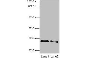 Western blot All lanes: RRAS2 antibody at 2. (RRAS2 抗体  (AA 1-204))