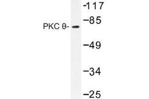 Image no. 1 for anti-Protein Kinase C, theta (PRKCQ) antibody (ABIN317883) (PKC theta 抗体)