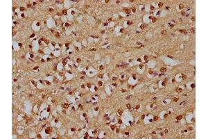 IHC image of ABIN7167791 diluted at 1:300 and staining in paraffin-embedded human brain tissue performed on a Leica BondTM system. (p130 抗体  (AA 417-616))