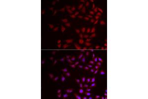 Immunofluorescence analysis of HeLa cells using CIRBP antibody.