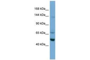Image no. 1 for anti-Tripartite Motif Containing 66 (TRIM66) (AA 359-408) antibody (ABIN6745662) (TRIM66 抗体  (AA 359-408))