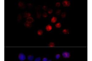 Immunofluorescence analysis of 293T cells using TOM1 Polyclonal Antibody at dilution of 1:100 (40x lens). (TOM1 抗体)