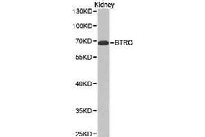 Western Blotting (WB) image for anti-beta-Transducin Repeat Containing (BTRC) antibody (ABIN1871369) (BTRC 抗体)