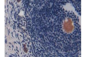DAB staining on IHC-P; Samples: Rat Ovary Tissue (CD8B 抗体  (AA 21-208))