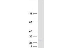 ZNF580 Protein (Transcript Variant 2) (Myc-DYKDDDDK Tag)