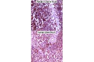 Immunohistochemical analysis of paraffin-embedded lymphocyte of human thymoma and human spleen tissue showing cytoplasmic localization using MAP2K4 monoclonal antibody, clone 2D10D8,4G11B2  with DAB staining. (MAP2K4 抗体)