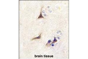 Formalin-fixed and paraffin-embedded human brain tissue reacted with NGFB antibody (Center) (ABIN392194 and ABIN2841899) , which was peroxidase-conjugated to the secondary antibody, followed by DAB staining.