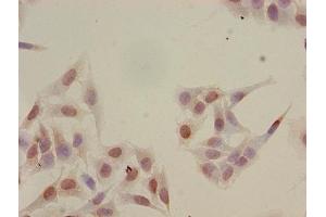 Immunocytochemistry analysis of Hela cells using ABIN7139165 at dilution of 1:100 (HIST1H2BB 抗体  (acLys16))