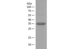 Western Blotting (WB) image for Integrin alpha-L (ITGAL) (AA 1112-1170) protein (His-IF2DI Tag) (ABIN7123469) (ITGAL Protein (AA 1112-1170) (His-IF2DI Tag))