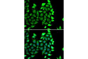 Immunofluorescence analysis of MCF-7 cells using IKZF3 antibody (ABIN4904027). (IKZF3 抗体)