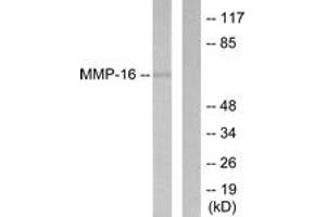 Western blot analysis of extracts from HepG2 cells, using MMP-16 Antibody. (MMP16 抗体  (AA 551-600))