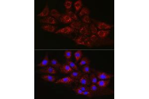 Immunofluorescence analysis of NIH/3T3 cells using CPT2 Rabbit pAb (ABIN6129249, ABIN6138983, ABIN6138984 and ABIN6216045) at dilution of 1:100 (40x lens). (CPT2 抗体  (AA 1-180))