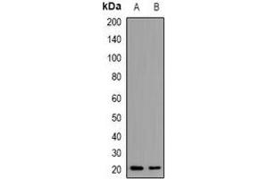 Western blot analysis of PTHRP expression in Hela (A), HepG2 (B) whole cell lysates.