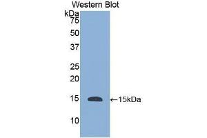 Detection of Recombinant HTN1, Human using Polyclonal Antibody to Histatin 1 (HTN1) (HTN1 抗体  (AA 20-57))