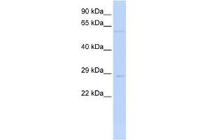 WB Suggested Anti-MRPL10 Antibody Titration: 0. (MRPL10 抗体  (N-Term))
