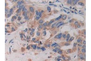 Immunohistochemistry (IHC) image for anti-Cysteine-Rich, Angiogenic Inducer, 61 (CYR61) (AA 178-381) antibody (ABIN7436243)
