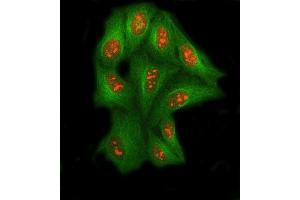 IF analysis of SSRP1 using anti-SSRP1 antibody (ABIN7600496) and anti-Tubulin Alpha antibody (ABIN7600339). (SSRP1 抗体  (AA 2-381))