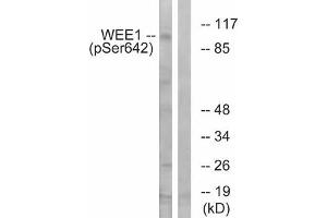 Western blot analysis of extracts from 293 cells treated with etoposide using WEE1 (Phospho-Ser642) Antibody. (WEE1 抗体  (pSer642))