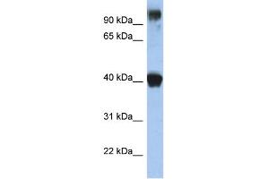 Western Blotting (WB) image for anti-Transcription Factor AP-2 epsilon (Activating Enhancer Binding Protein 2 Epsilon) (TFAP2E) (N-Term) antibody (ABIN2779389)