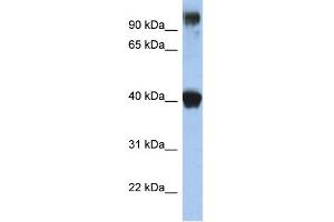 WB Suggested Anti-TFAP2E Antibody Titration:  0.