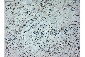 Immunohistochemical staining of paraffin-embedded colon tissue using anti-PROM2mouse monoclonal antibody. (Prominin 2 抗体)