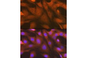 Immunofluorescence analysis of C6 cells using  antibody (ABIN7265552) at dilution of 1:100. (ALKBH1 抗体)
