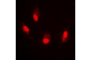 Immunofluorescent analysis of Histone H4 (AcK8) staining in HeLa cells.
