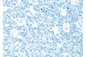 Immunohistochemistry (IHC) image for anti-Poly (ADP-Ribose) Polymerase 1 (PARP1) (AA 215-265) antibody (ABIN7455116) (Recombinant PARP1 抗体  (AA 215-265))