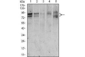 Western blot analysis using FOXP1 mouse mAb against HeLa (1), Jurkat (2), MCF-7 (3), T47D (4), and Raw264. (FOXP1 抗体  (AA 481-677))
