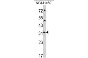 Western blot analysis of CER1 Antibody in NCI-H460 cell line lysates (35ug/lane) (CER1 抗体  (N-Term))