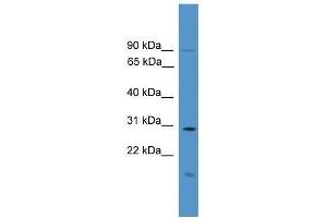 Western Blot showing RASSF1 antibody used at a concentration of 1. (RASSF1 抗体  (C-Term))