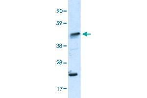 Western Blot analysis of human fetal skeletal muscle tissue lysate with IKZF5 polyclonal antibody  at 0. (IKZF5 抗体  (N-Term))
