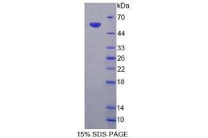 SDS-PAGE analysis of Rat TNR Protein.