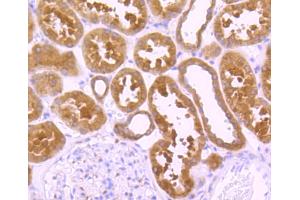 Immunohistochemistry (Paraffin-embedded Sections) (IHC (p)) image for anti-Peroxiredoxin 1 (PRDX1) antibody (ABIN5557512)