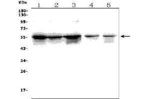 Western blot analysis of TRIM6 using anti-TRIM6 antibody (ABIN7601905).