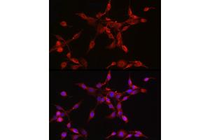 Immunofluorescence analysis of PC-12 cells using ORP1 Rabbit mAb (ABIN7269136) at dilution of 1:50 (40x lens).