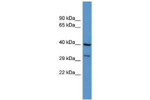 WB Suggested Anti-Dusp11 Antibody Titration: 0. (DUSP11 抗体  (N-Term))