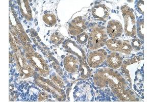 RNF165 antibody was used for immunohistochemistry at a concentration of 4-8 ug/ml to stain Epithelial cells of renal tubule (arrows) in Human Kidney. (RNF165 抗体  (Middle Region))