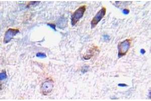 Immunohistochemistry (IHC) analyzes of p-PDGFR beta antibody in paraffin-embedded human brain tissue. (PDGFRB 抗体  (pTyr751))