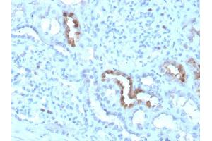 Formalin-fixed, paraffin-embedded human Kidney stained with Calbindin 1 Mouse Monoclonal Antibody (CALB1/3333). (CALB1 抗体  (AA 7-96))