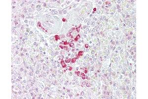 Anti-FRZB antibody IHC of human spleen. (FRZB 抗体  (AA 216-265))