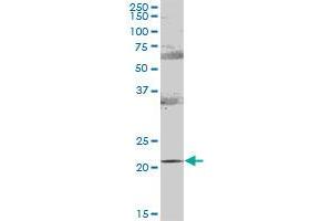 RAB31 MaxPab polyclonal antibody. (RAB31 抗体  (AA 1-195))