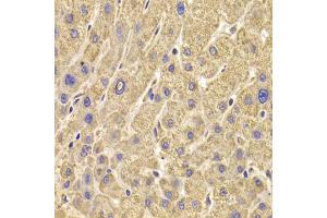 Immunohistochemistry of paraffin-embedded human liver injury using PEX5 antibody (ABIN5973402) at dilution of 1/100 (40x lens). (PEX5 抗体)