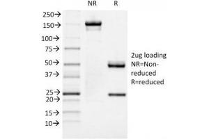 SDS-PAGE Analysis of Purified, BSA-Free FOXA1 Antibody (clone FOXA1/1519).